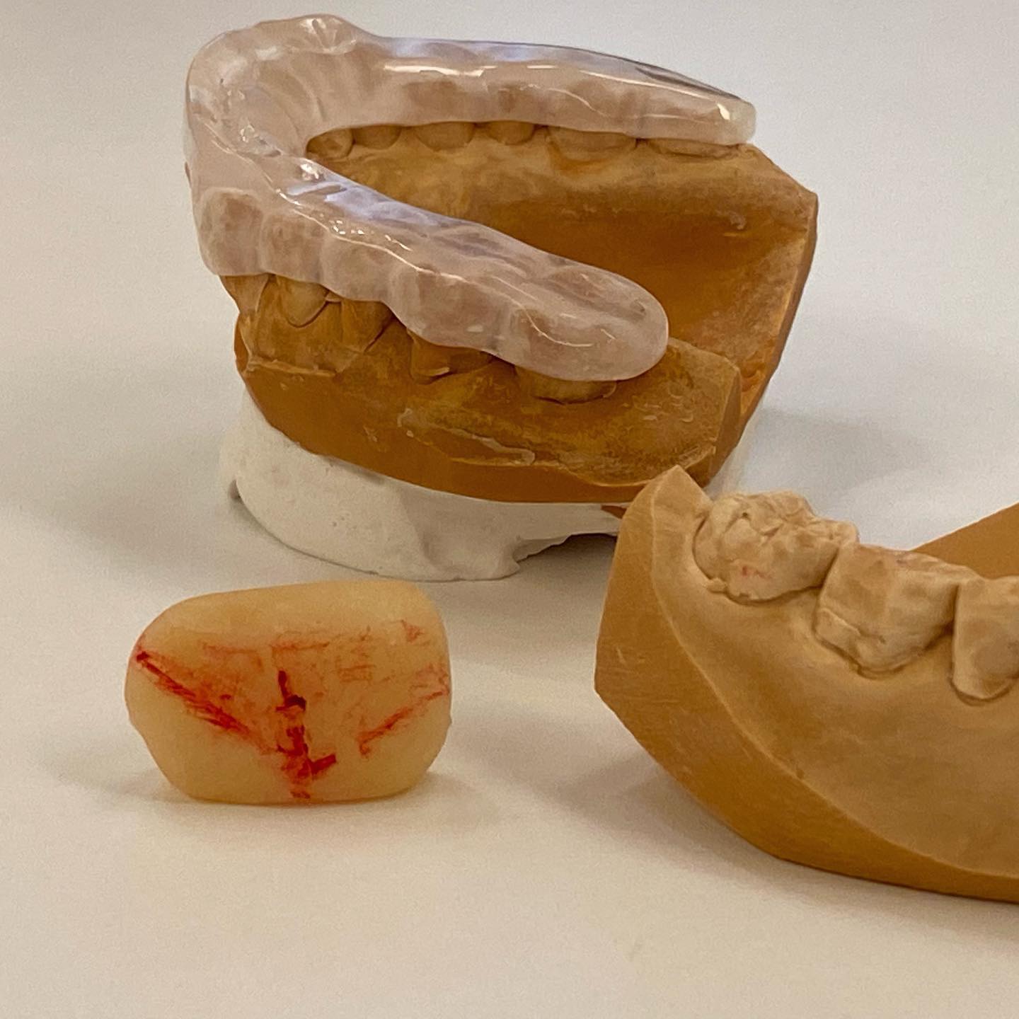こんにちは🥳こちらは当院のこだわりのあるマウスピースです🦷とても腕の良い技工士さんに作っていただいてもらってます！！！院長は、患者さんの顎の動きをよく診て情報提供し技工士さんと連携していますスズメの足跡のような3本の赤い線が顎の動きの記録です🖊#東京ステーション歯科クリニック #東京駅 #東京駅歯科 #歯科医師 #歯科技工士 #歯科衛生士 #歯科助手#歯科技工物 #スプリント #マウスピース #噛み合わせ #咬合
